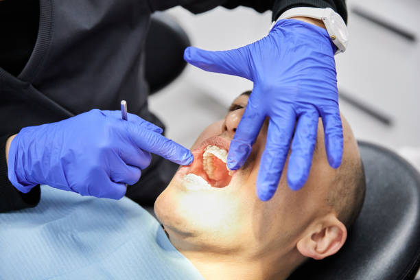 Best Emergency Broken Tooth Repair in Avalon, CA
